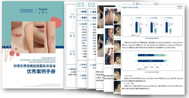 妙思乐：循证守护婴童肌肤健康，以全球科研沉淀深耕中国AD